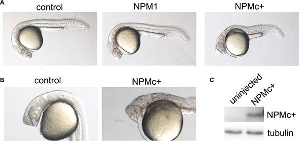 Embryo morphology after NPM1 and NPMc+ expression in zebrafish embryos.