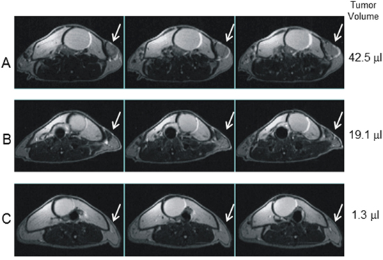 Magnetic resonance imaging of CTX+ACT/IS-treated tumor.