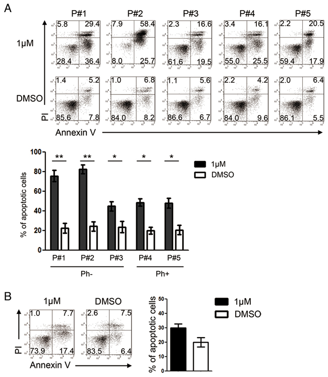 GZD824 induces apoptosis of primary pre-B ALL cells from patients with no toxicity to normal B cells.