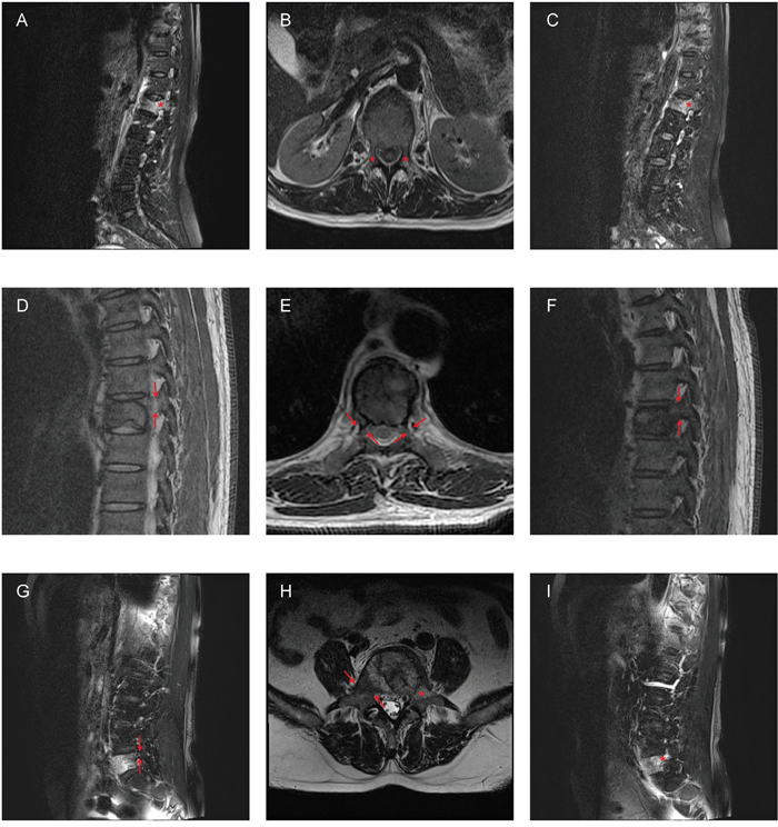 Examples of misdiagnosis according to MRI images.