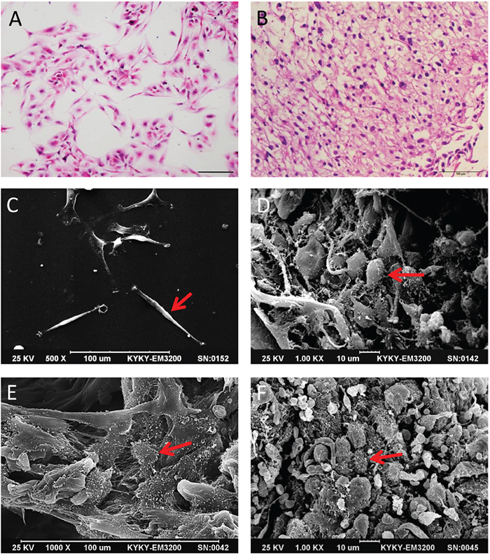 Comparison of glioma cell morphology by H&#x0026;E staining and SEM.
