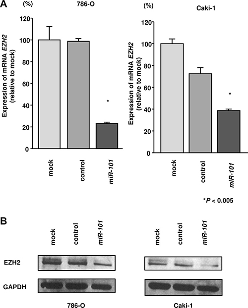 Effects of miR-101 transfection on EZH2 mRNA and protein expression in RCC cells.