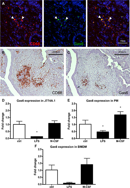 In vivo and in vitro expression of Gas6 in human and murine macrophages.