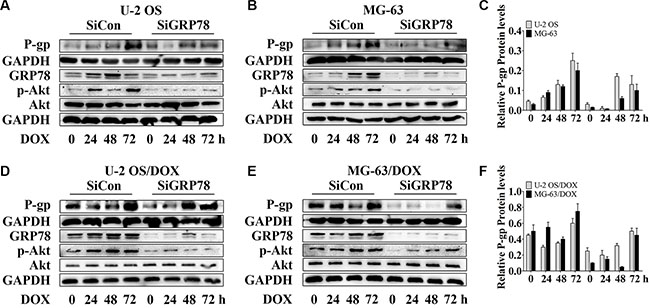 Knockdown of GRP78 slightly prevents DOX-induced P-gp expression in OS parental cell lines and resistant sublines.