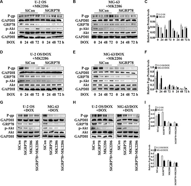 GRP78 inhibition enhances the inhibitory effect of MK2206 on P-gp expression.