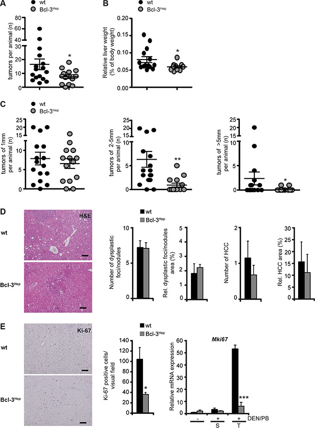 Overexpression of hepatic Bcl-3 attenuated DEN/PB-induced HCC in mice.