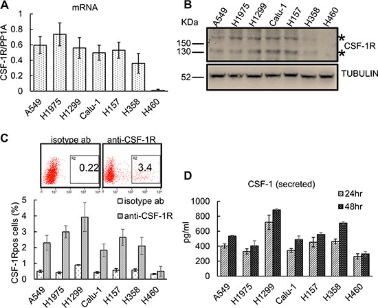 Lung cancer cell lines express CSF-1R and CSF-1 and contain CSF-1Rpos cell subpopulations.