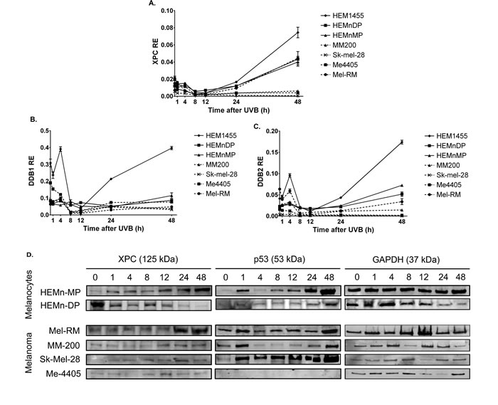 Expression of GGR and p53 in melanocytes and melanoma cell lines after treatment with 650J/m