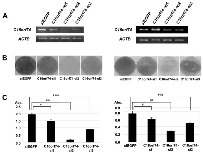 Effect of knockdown of C16orf74 on cancer cell growth.