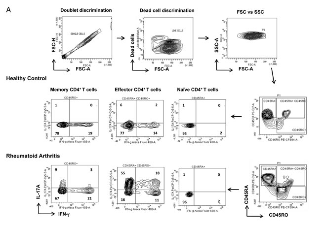 Characterization of inflammatory T helper cells in Rheumatoid Arthritis.