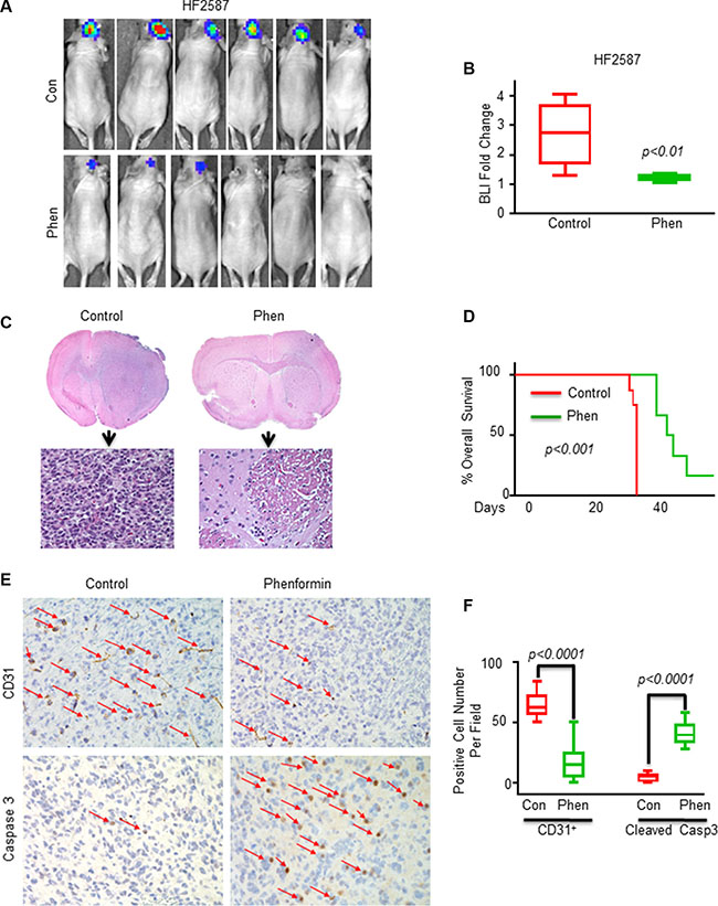 Phenformin inhibits tumor growth and angiogenesis, induces apoptosis and increases the overall survival in GSC-derived xenografts.