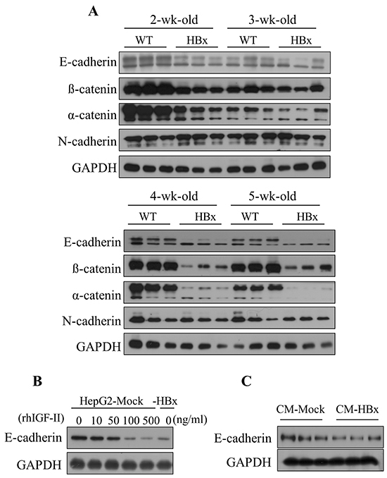 HBx induced IGF-II downregulates the expression level of E-cadherin in mouse livers and HepG2 cells.