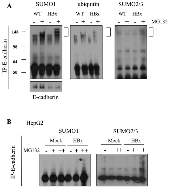 E-cadherin was degraded by SUMOylation in mouse livers and HepG2 cells.