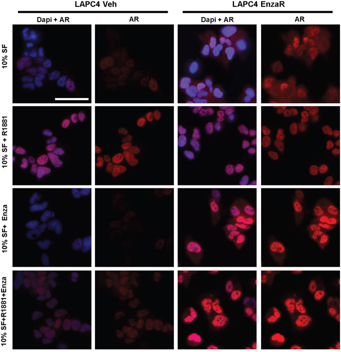 Immunofluorescence staining of vehicle or enzalutamide resistant LAPC4 cells.