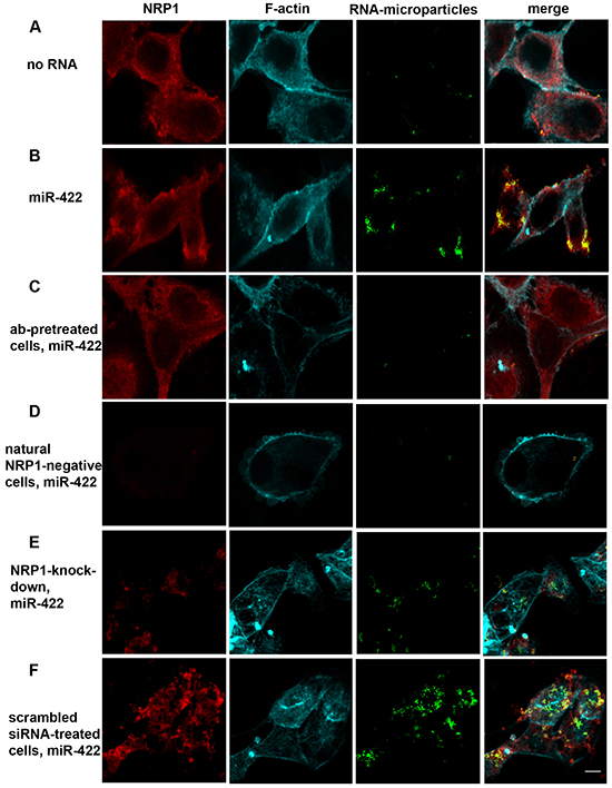 Biotinylated miR-422 conjugated to fluorescent streptavidin-coated microparticles binds to NRP1 expressed by ACHN cells and translocates into the cytoplasm.