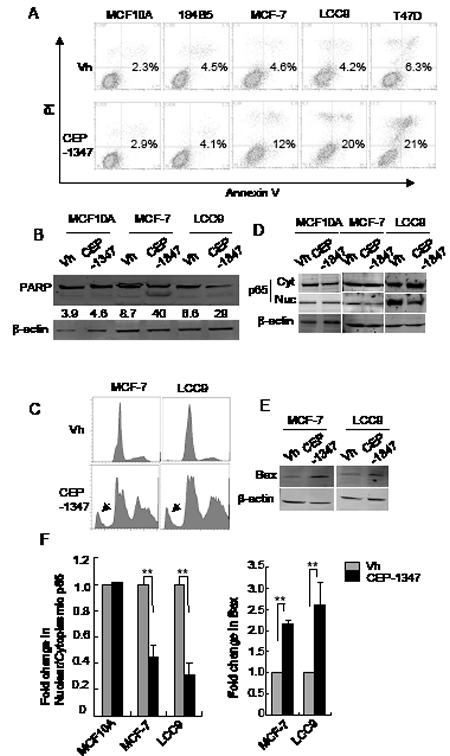 MLK inhibition induces apoptosis in breast cancer cells but not in non-tumorigenic cells.