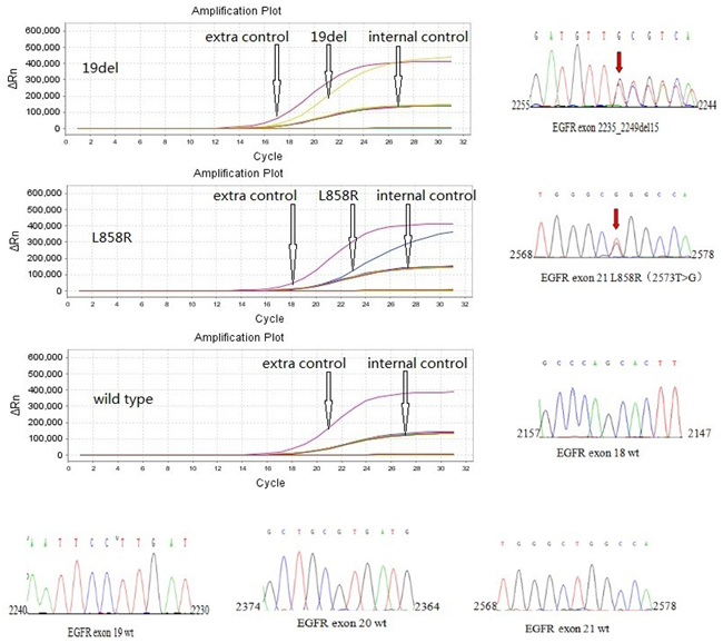 Representative results of EGFR mutation in exon19 (deletion) and exon 21 (L858R point mutation), and wild-type of EGFR using a HGN EGFR Mutations Detection Kit.