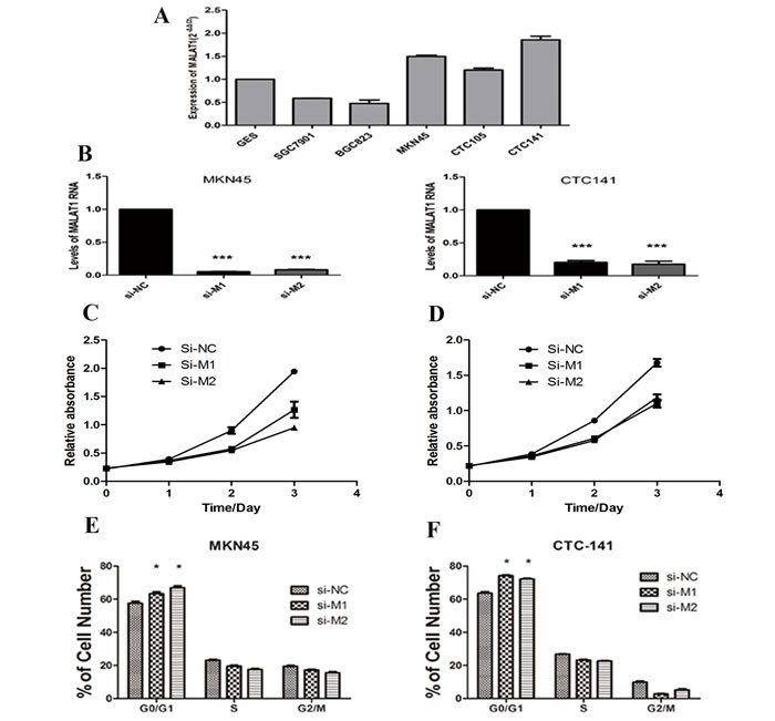 MALAT1 expression levels in gastric cancer cell lines and the effect of MALAT1 on cell proliferation.