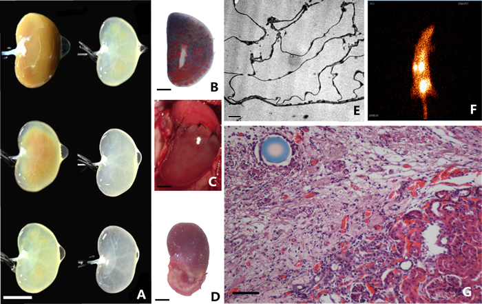 Fabrication and implantation of decellularized kidney scaffolds.