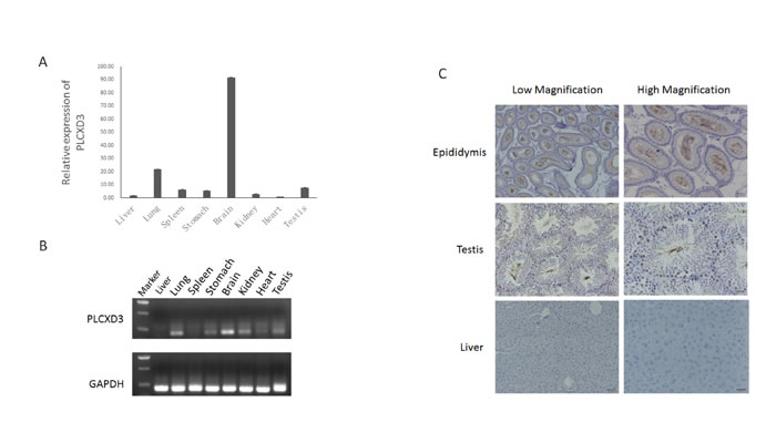 Expression pattern of PLCXD3 in selected mouse tissues.