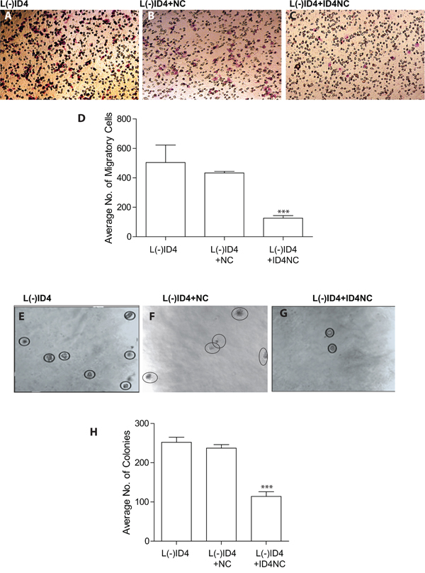 Motility, invasion and anchorage independent growth of L(-)ID4 cells treated with ID4 nano carrier (ID4NC).