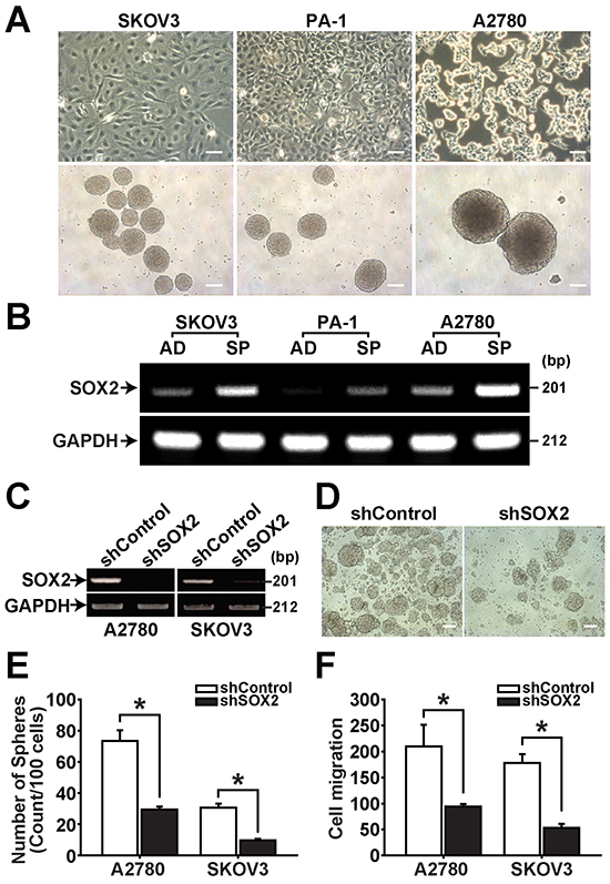 SOX2 expression is increased in spheres of ovarian cancer cells.