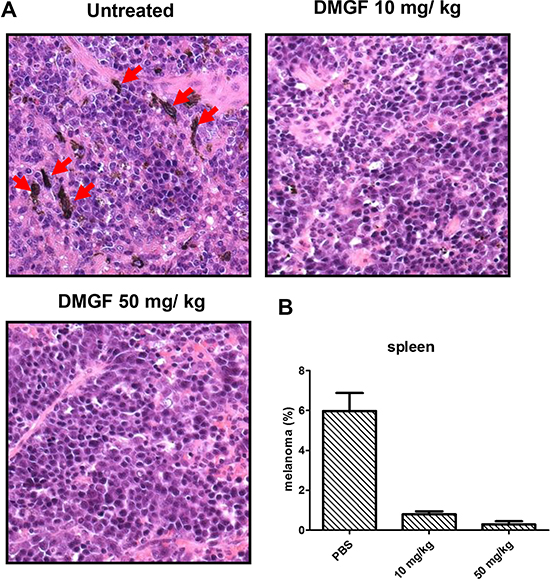 Effect of DMGF on spontaneous metastasis in the spleen.