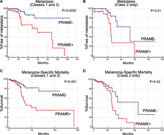 Prognostic significance of PRAME expression status in uveal melanoma.