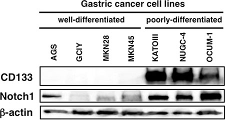 Cleaved Notch1 and CD133 protein expression in human gastric cancer cell lines.