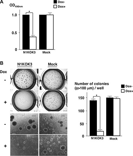 Silencing Notch1 reduced cell proliferation and anchorage independent cell growth.