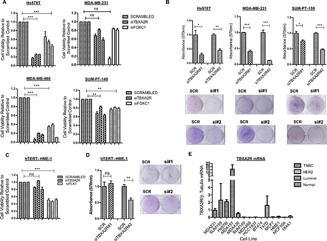 TBXA2R is a basal-specific marker and promotes survival of TNBC cells.