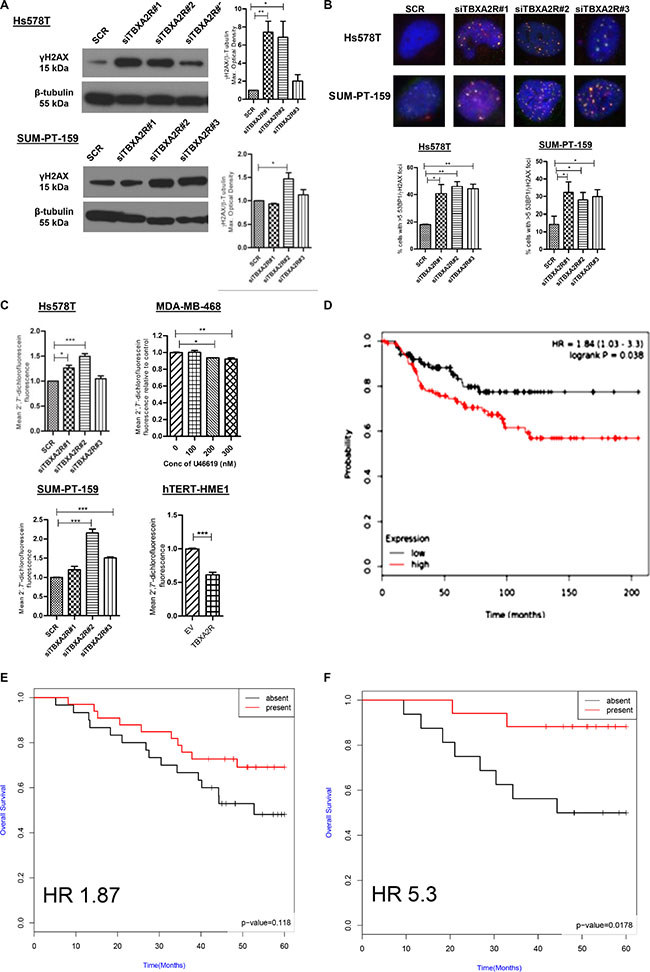 TBXA2R knockdown induces markers of DNA damage and ROS in TNBCs with TBXA2R expression correlating with TNBC clinical outcomes.
