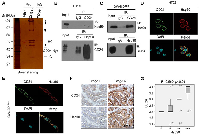 Hsp90 was one of the candidate protein interacting with CD24 in human CRC cells.