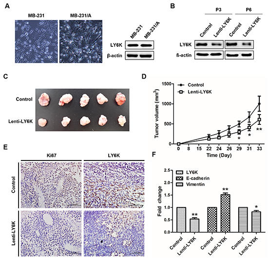 Tumorigenesis effect of LY6K in vivo.