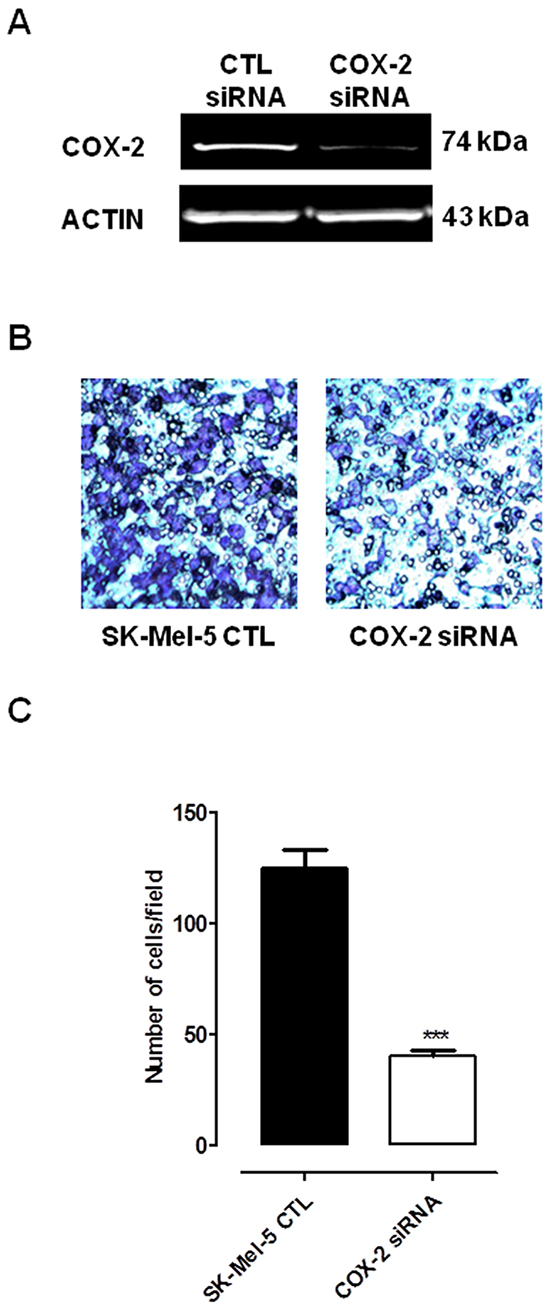 Silencing of COX-2 gene in Sk-Mel-5 cells significantly decreases melanoma cell invasiveness.