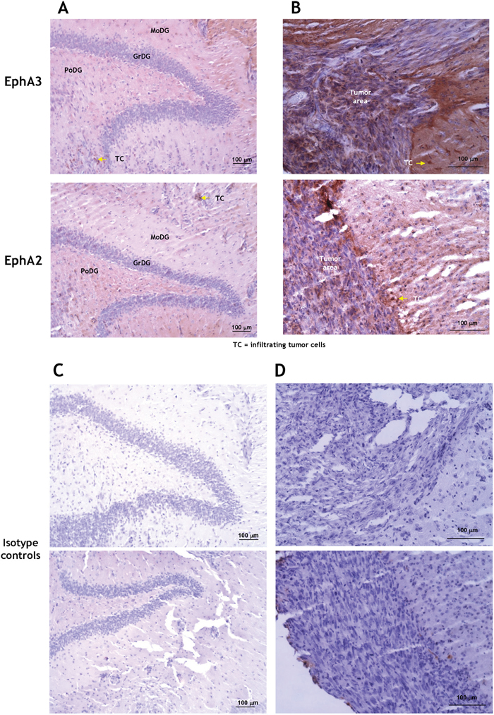 Immunohistochemistry for EphA3 and EphA2 in a mouse brain carrying G48a tumors.