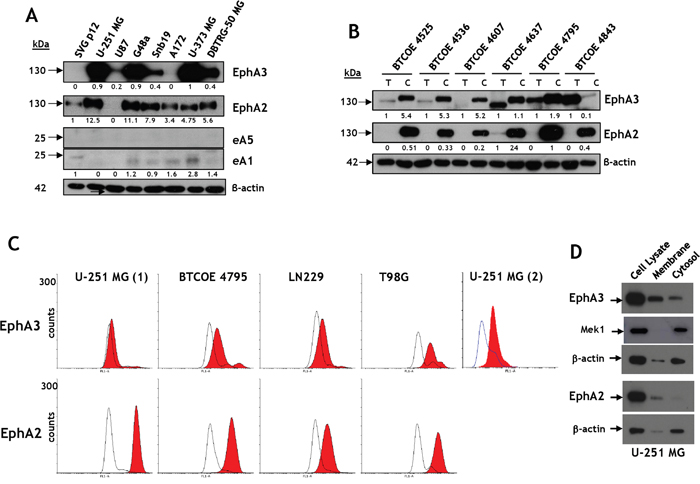 Eph receptor A3 is over-expressed in GBM cell lines and tumors.