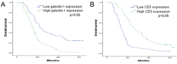 Kaplan-Meier curve of overall survival based on galectin-1 and CD3 expression in 162 HCC patients.