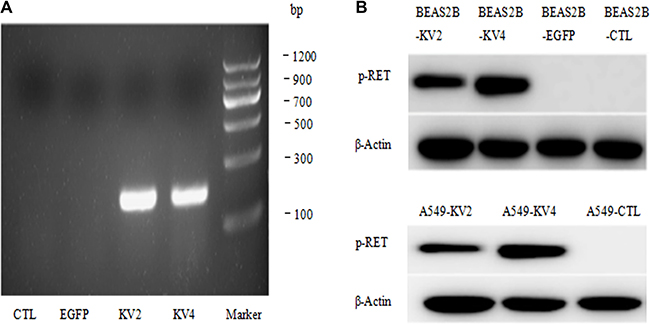 Establishment of stable transfected BEAS-2B and A549cell lines.