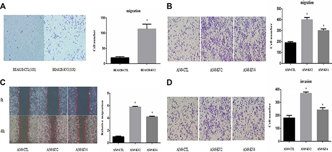 KIF5B-RET fusion gene promoted migration and invasion of cancer cells in vitro.