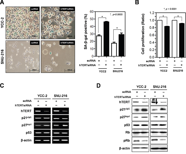 Ablation of hTERT altered the cell proliferation and cellular senescence of gastric cancer cells.