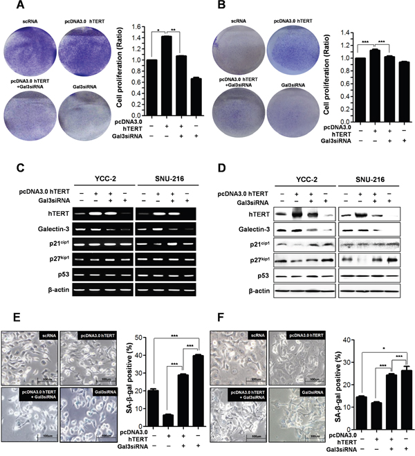 Depletion of galectin-3 after hTERT overexpression on the cell proliferation and cellular senescence of human gastric cancer cells.