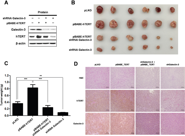 Knockdown of galectin-3 reduces tumor burden in gastric cancer cell xenografted mice, effect that is reversed by overexpression of hTERT.