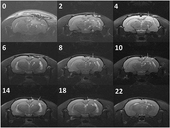 Serial MRI images of the BICC group.