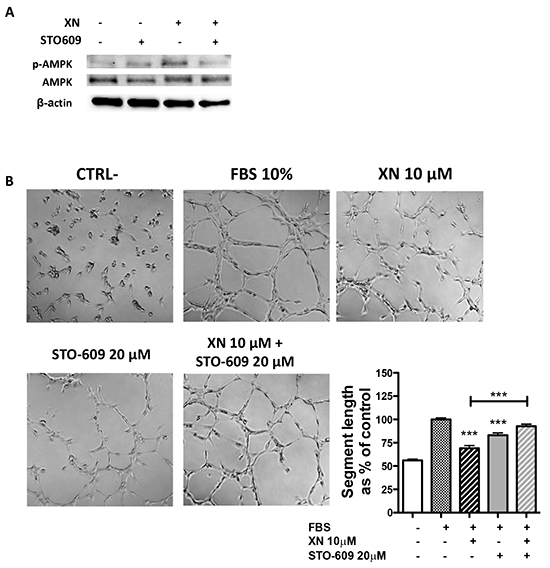 The role of CaMKK&#x03B2; in XN-induced AMPK activation.