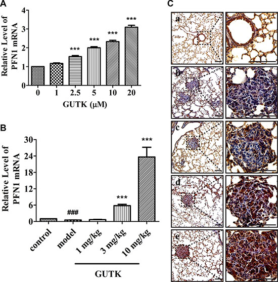 GUTK induces increases in the mRNA and protein expression levels of PFN1 in vitro and in vivo.