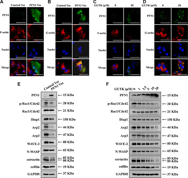 GUTK and PFN1 regulate key proteins involved in cell motility and metastasis.