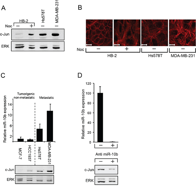 miR10b regulates the expression of c-Jun in breast cancer cells.
