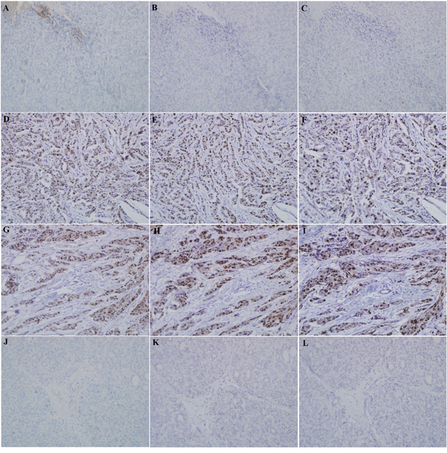 The expression of Lin28A, AR, and Ki67 in xenograft tumor was detected by using immunohistochemistry.