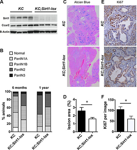 Pancreatic lesions in KC and homozygous KC;Sirt1-lox mice.